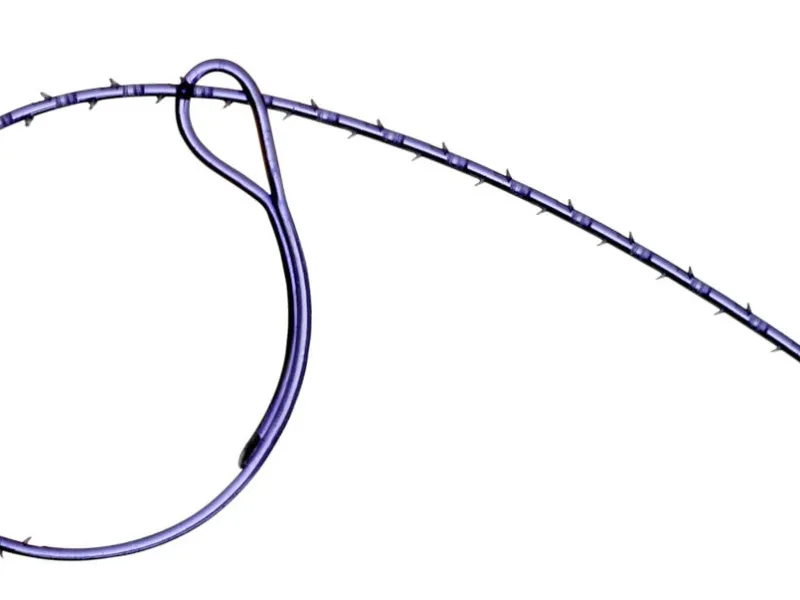 gastrik-bypass-nedir