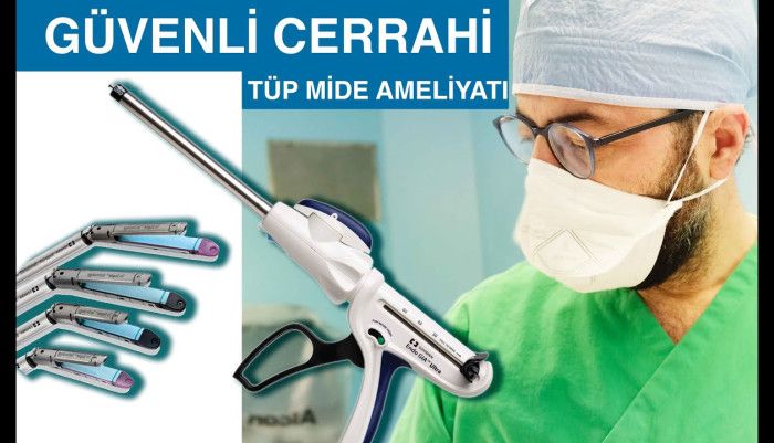 #dromeravlanmis,#tupmideameliyati,#obezitecerrahisi,güvenlicerrahi,midebotoksu,midebotox,midebalonu,midefiyatı,tüpmidefiyatı,midebotoksufiyat,midebalonufiyatı,istanbul,izmir,istanbuldamideküçültme,mideküçültmefiyatı